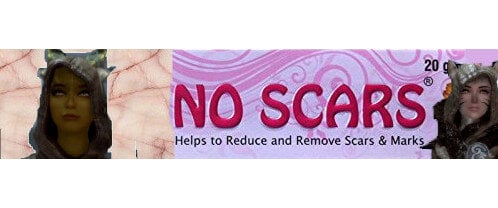 No Beast Scars